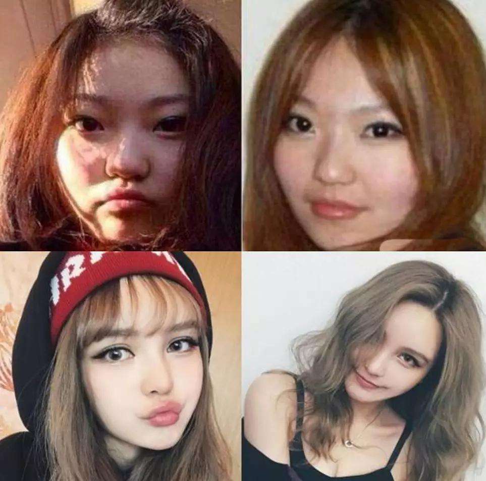 ��������ǰ������ͼƬ ������ǰ��ԱȲ������