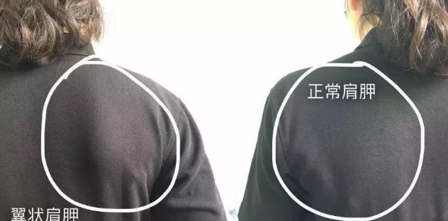 ��������ʲô���ӵ�ͼƬ �����������ʲô��λ