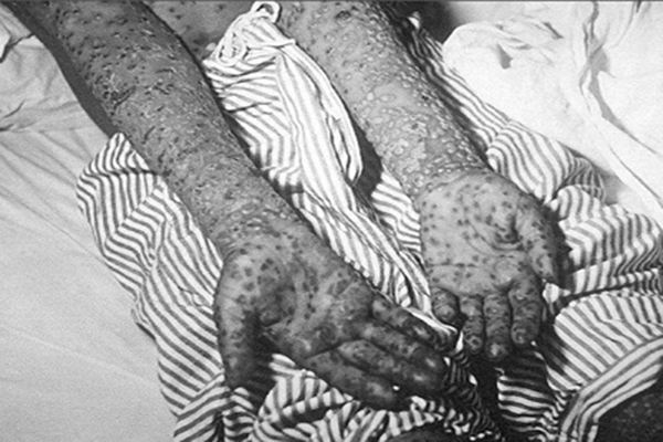 史上十大最可怕的生化武器图片慎点 打赌你听过的绝不会超过3种