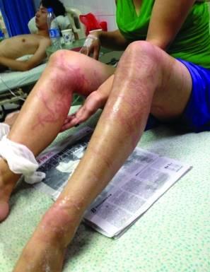 �������ϴ���ɮñˮĸ���˾���������ͼƬ ��ô����Ū��ɮñˮĸ