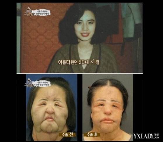 ����ɵ��͵�����ʧ�ܳ���ͷ���Ұ��� ��������ڵ������з�˿��