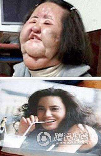 ����ɵ��͵�����ʧ�ܳ���ͷ���Ұ��� ��������ڵ������з�˿��