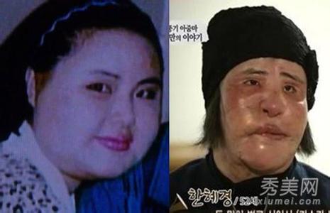 ����ɵ��͵�����ʧ�ܳ���ͷ���Ұ��� ��������ڵ������з�˿��