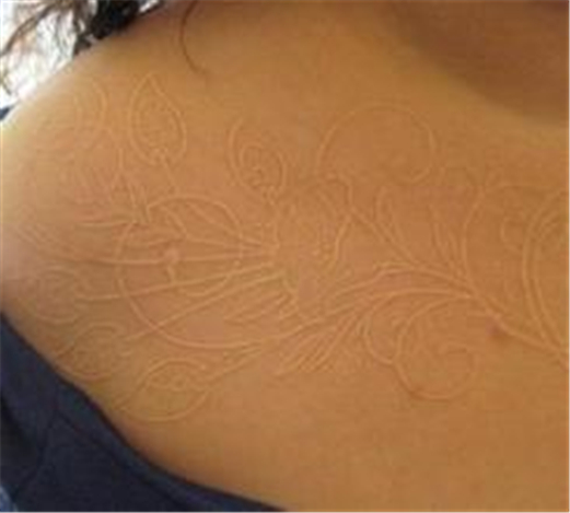 ����Ѫ�����Ⱦ�ǰ����ô���������� ����Ѫ��������ס����ʵ����