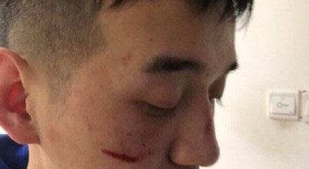 ��������ʲô��������ʲô ������Ϊʲô��������ô���������Ƥ