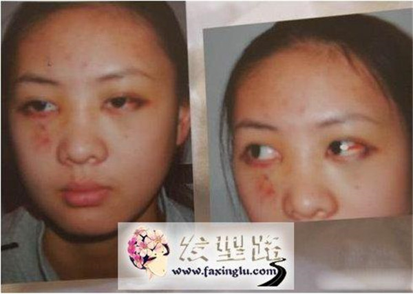 ˭���Ź����㶨�ƶ�����Ƿ�С���� �Ź����ͻƶ�����ʲô��Թ��