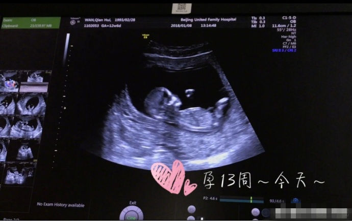 音乐人三宝结过几次婚前妻有几个情史 三宝为何娶万千惠是真爱吗