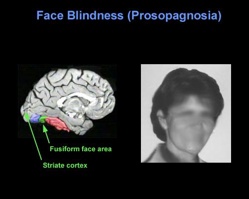 ��ä֢�����е������Ȼ������ ��΢��ä����Щ֢״������ô�˷�