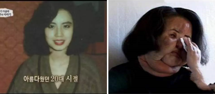 ���۾���������񫡷��������ʹ���� ��ü��Ŀ�㵽������