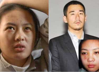 ͯ��������ı�ϵ���λƶ���Ǳ���� ͯ�����Ź����ſ���ô����