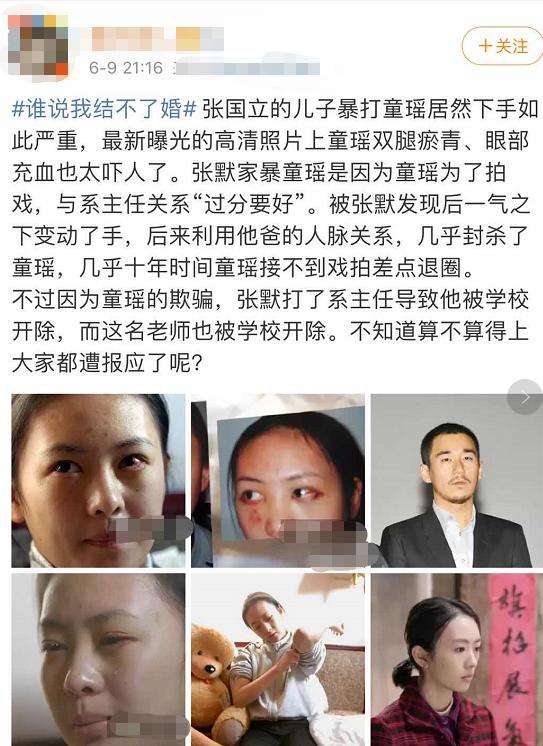 ͯ��������ı�ϵ���λƶ���Ǳ���� ͯ�����Ź����ſ���ô����