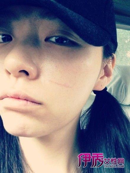����ӱ�۾���ô��������һ��һС ����ӱ���۾��Ǽٵ�������ô��