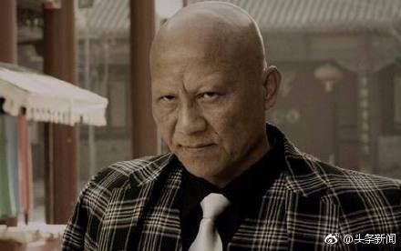 ��Ա�ƴ���ȥ��ԭ��ʲô��������� �ƴ���Ϊʲôû��üë��ͷ��