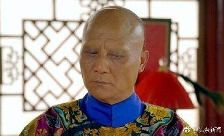 ��Ա�ƴ���ȥ��ԭ��ʲô��������� �ƴ���Ϊʲôû��üë��ͷ��