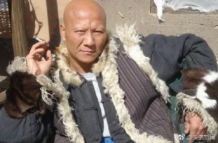 ��Ա�ƴ���ȥ��ԭ��ʲô��������� �ƴ���Ϊʲôû��üë��ͷ��