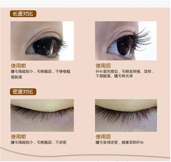 贝特优美睫毛增长液怎么样有副作用吗 贝特优美可以涂眉毛吗