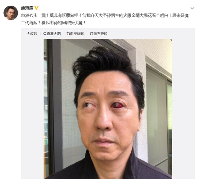 �׳���Ϊ���۾�������ô�˿��Ŷ��� ����ô����ĺ�����������Ϣ