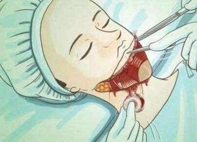 �̵㺫����ֲ����� ǿ�Ƹ��¿����˹����µ���ֹ��ס�����ĵ���