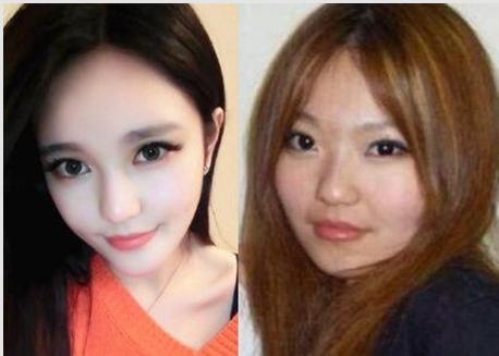 看周扬青真人害怕 周扬青变脸过程都整了哪些地方整容前照片