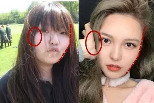 看周扬青真人害怕 周扬青变脸过程都整了哪些地方整容前照片