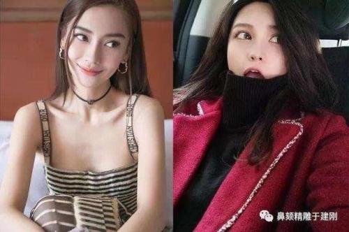 看周扬青真人害怕 周扬青变脸过程都整了哪些地方整容前照片