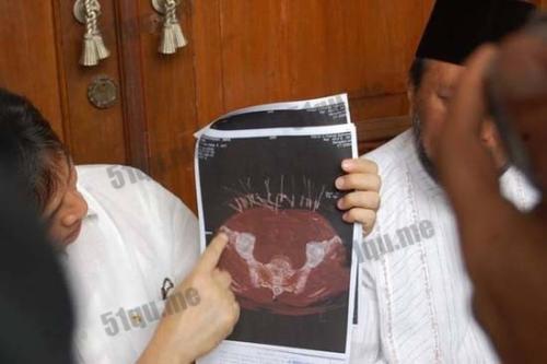 �˳��������ָ�˿ŮŬ�������峤��˿ͼƬ ���칦���˵���ʵ�¼�