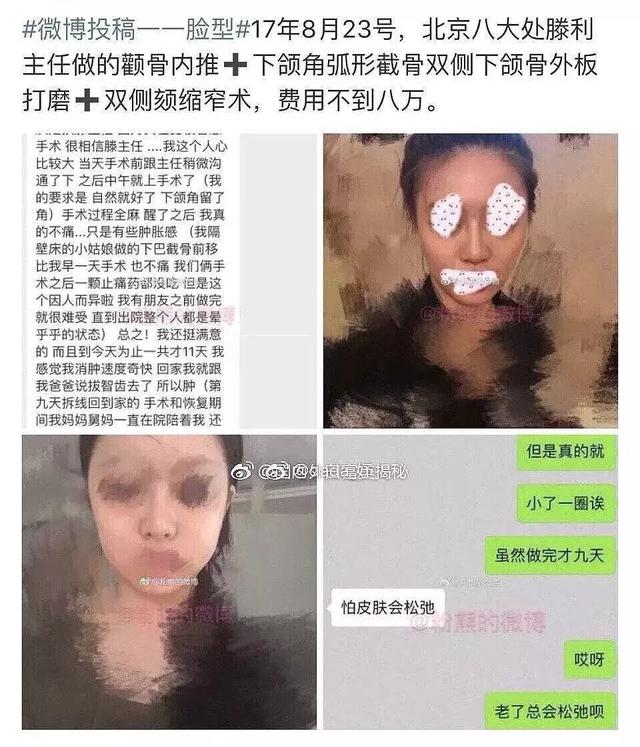 ��������������һ������ܻ���ͼ ������ԭ����������ǰ���ճ��