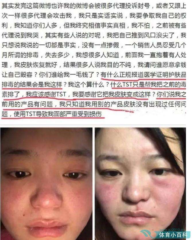 tst��ͥ����Լ�������ʲôƷ�� tst��ױƷ�ͻ���Ʒ������ô��