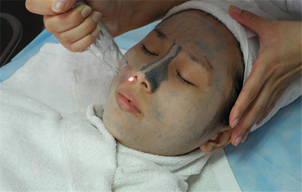 黑脸娃娃效果怎么样多久做一次好 黑脸娃娃三年后真的有副作用吗