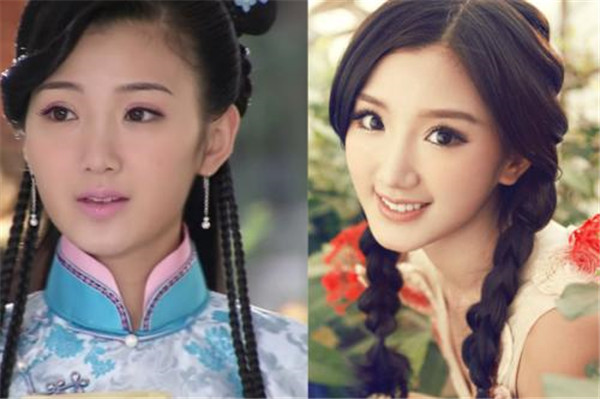 毛晓彤整容前后对比照片曝光 毛晓彤是不是开眼角了疤痕好明显