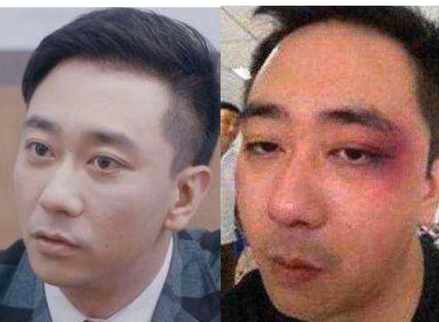 �����Խ����ұ�ϸ����Ƶ�����ع� ���Խ���Ӧ�ұ����ȶ��ⱻ����