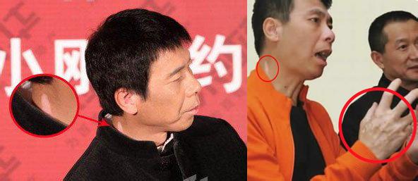 ���ط�С�ղ�����ѷ�������������� ��С������������ô����