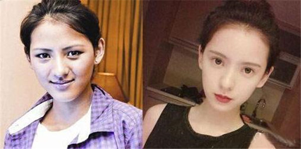 张予曦整容了吗前后对比照片差距大 张予曦是混血吗长得太美了吧