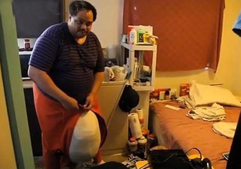 世界上最大的睾丸 有相当于一个成年男子体重的睾丸怎么夫妻生活