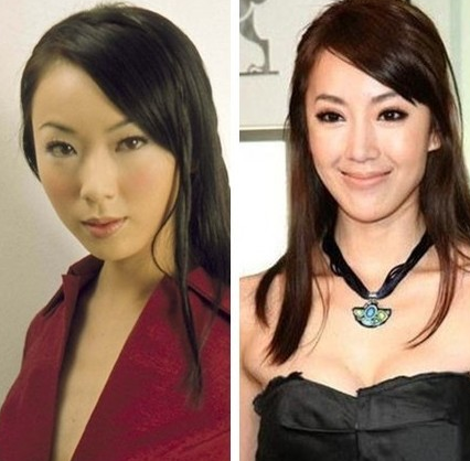 隋棠金钟春光乍泄全部高清大图 隋棠拍广告忘记戴胸罩整容前后图