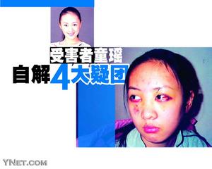 ͯ��ΪʲôҪ��ƶ��� �ƶ������ͯ����һ���������