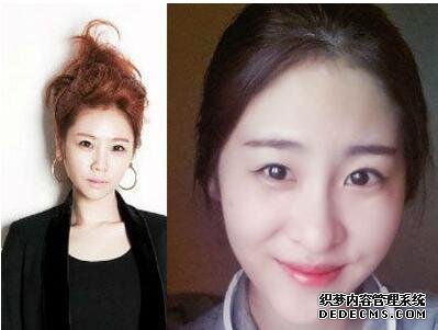 张碧晨整容前真吓人惊悚丑照 张碧晨的鼻子好恐怖鼻孔一大一小图