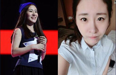 张碧晨整容前真吓人惊悚丑照 张碧晨的鼻子好恐怖鼻孔一大一小图