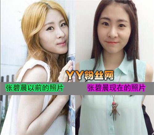 张碧晨整容前真吓人惊悚丑照 张碧晨的鼻子好恐怖鼻孔一大一小图