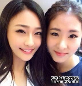 张碧晨整容前真吓人惊悚丑照 张碧晨的鼻子好恐怖鼻孔一大一小图