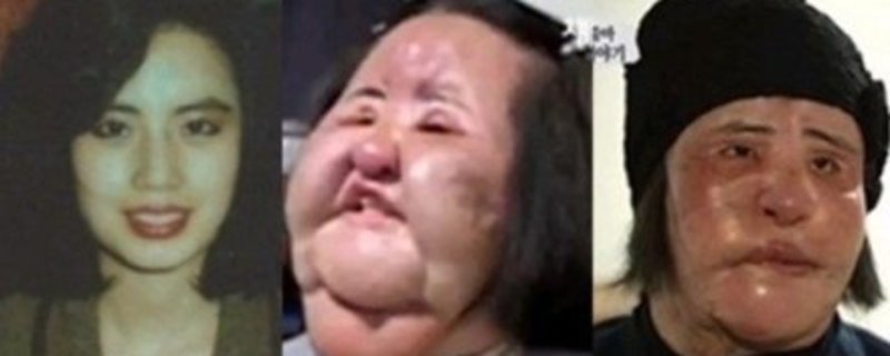 ����Ȱ���ȥ������