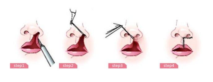 ����Ϊʲô���ô�ԭ������ ���̴������Ǽ����ô����˶���Ǯ