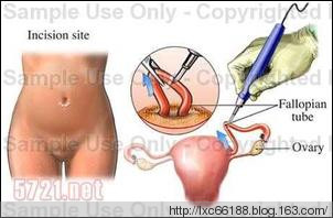 Ů�˽���������ʵ���� Ů������������λ��ͼ