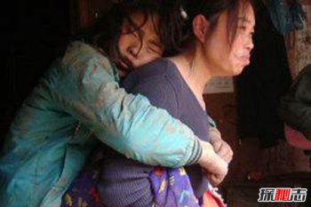 蛇女兰兰得了什么病 蛇娃真相