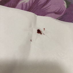 ��α���Ƿ񱻴�ʭҧ ��ϸ��鱻��ҧ��