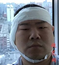 ��������������ô���� ���沿��������Ϊ������