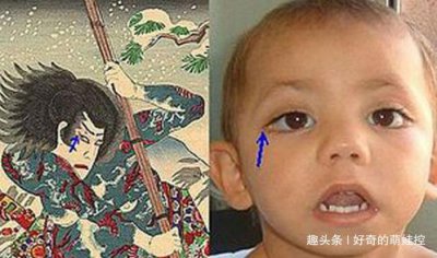 歌舞伎面谱综合症真的漂亮吗 为什么会长得漂亮