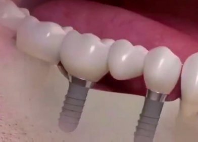 ��ֲ��һ�Ŵ�Ŷ���Ǯ һ�㶼Ҫ��1��Ԫ����