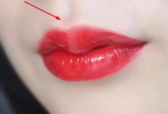 唇珠为什么很少人有 大多数都是父辈遗传的