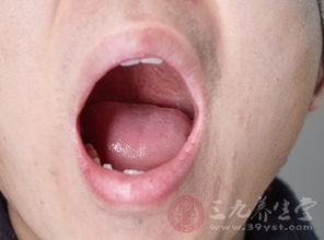 舌头发白怎么调理 饮食宜清淡多吃健脾胃的食物